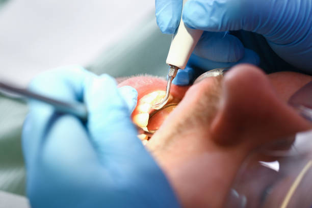 Best Emergency Dentist for Lost Fillings or Crowns in Las Animas, CO